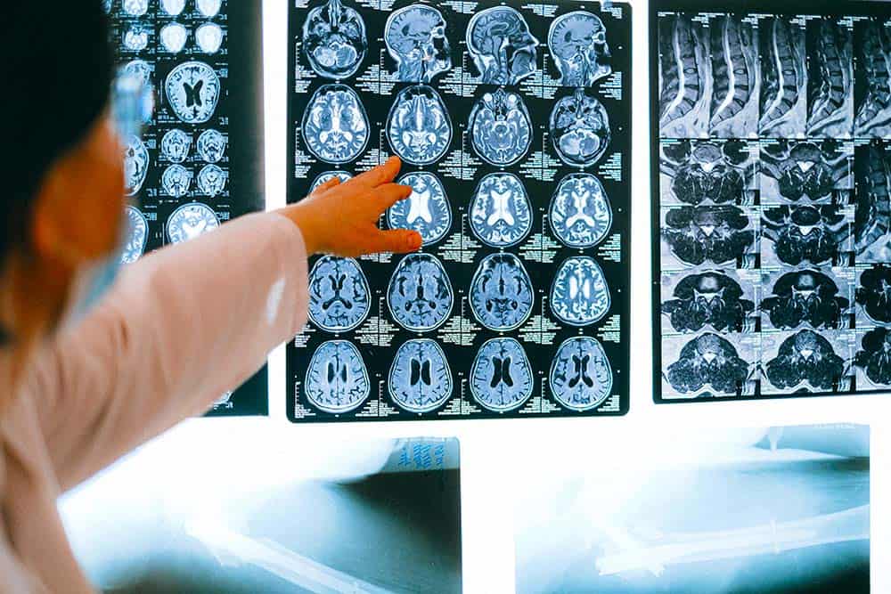 Medical Conditions Caused by Alcoholism